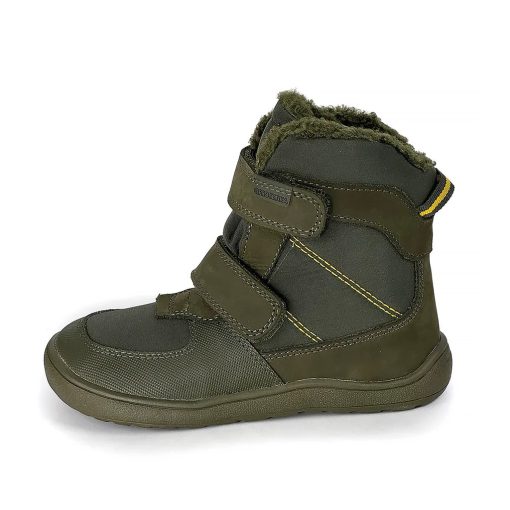 PROTETIKA DOROTY BEIGE
