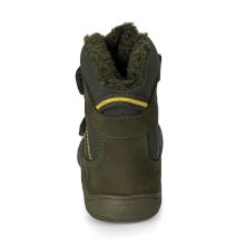 PROTETIKA DOROTY BEIGE