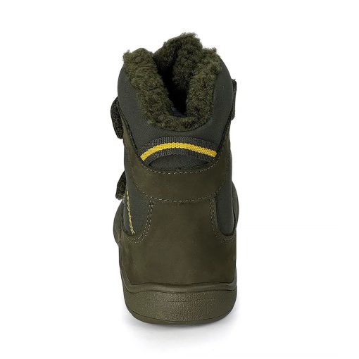 PROTETIKA DOROTY BEIGE