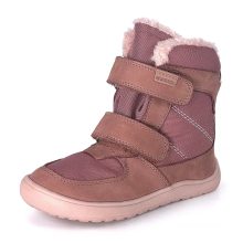 PROTETIKA DOROTY BEIGE