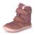 PROTETIKA DOROTY BEIGE