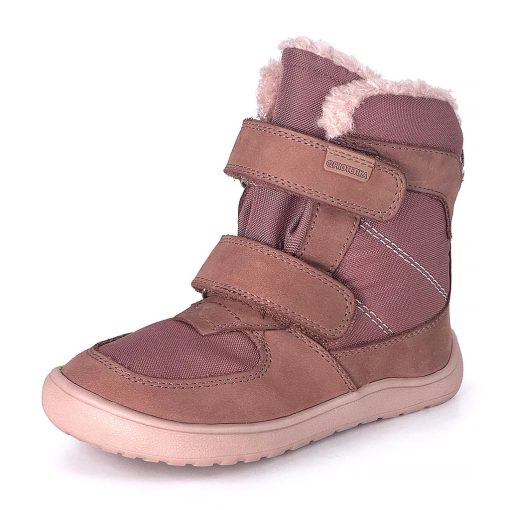 PROTETIKA DOROTY BEIGE